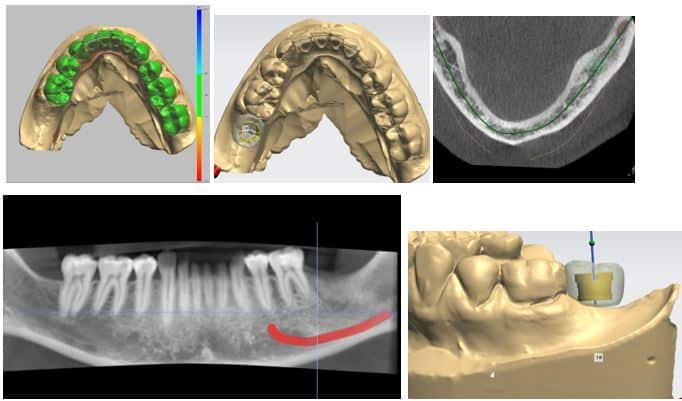 CBCT-IMAGING-1Capture